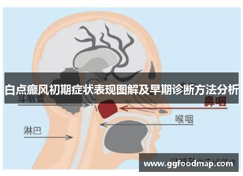 白点癫风初期症状表现图解及早期诊断方法分析